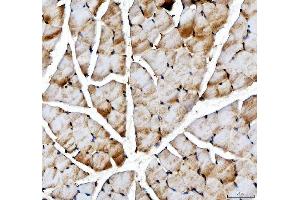 IHC analysis of ACSS2 using anti-ACSS2 antibody (ABIN7600569). (ACSS2 anticorps  (AA 201-651))