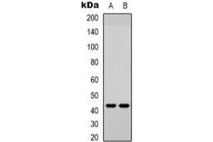 Western blot analysis of JUND (pS255) expression in Jurkat (A), HEK293T (B) whole cell lysates. (JunD anticorps  (C-Term, pSer255))