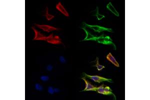 ABIN6259847 and ABIN6277044 staining Hela cells by IF/ICC. (AK4 anticorps  (Internal Region))