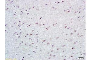 Formalin-fixed and paraffin embedded rat brain tissue labeled with Anti-Cathepsin B Polyclonal Antibody, Unconjugated at 1:200 followed by conjugation to the secondary antibody, (SP-0023), and DAB staining (Cathepsin B anticorps  (AA 251-339))