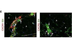 Human chemokine/receptor expression in prostate cancer and WAT. (CXCR1 anticorps  (C-Term))