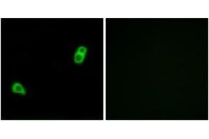 Immunofluorescence analysis of LOVO cells, using GPR34 Antibody. (GPR34 anticorps  (AA 181-230))
