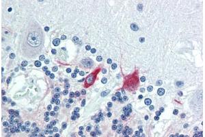 Human Brain, Cerebellum (formalin-fixed, paraffin-embedded) stained with MAP2 antibody ABIN462127 followed by biotinylated anti-mouse IgG secondary antibody ABIN481714, alkaline phosphatase-streptavidin and chromogen.