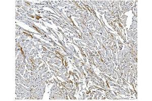 IHC analysis of ARF6 using anti-ARF6 antibody (ABIN4886473). (ARF6 anticorps  (AA 2-175))