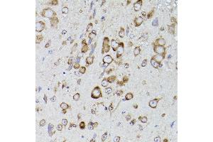 Immunohistochemistry of paraffin-embedded mouse brain using P4HB antibody (ABIN6134876 and ABIN6145140) at dilution of 1:150 (40x lens). (P4HB anticorps)