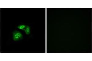 Immunofluorescence analysis of A549 cells, using VN1R5 Antibody. (VN1R5 anticorps  (AA 44-93))