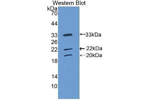 Detection of Recombinant CLL1, Human using Polyclonal Antibody to Collectin Liver 1 (CLL1) (COLEC10 anticorps  (AA 34-277))