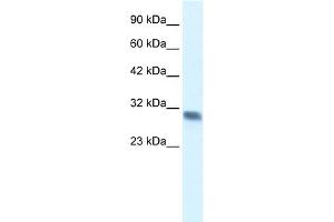 WB Suggested Anti-FHL2 Antibody Titration:  0. (FHL2 anticorps  (C-Term))