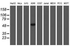 Image no. 10 for anti-NADH Dehydrogenase (Ubiquinone) Complex I, Assembly Factor 7 (NDUFAF7) antibody (ABIN1499667) (NDUFAF7 anticorps)