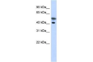 Tropomodulin 2 antibody used at 1 ug/ml to detect target protein. (TMOD2 anticorps)