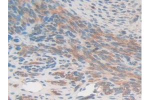 Detection of GSN in Mouse Uterus Tissue using Polyclonal Antibody to Gelsolin (GSN)