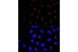 Confocal immunofluorescence analysis of U2OS cells using KRR1 Polyclonal Antibody  at dilution of 1:100.