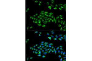 Immunofluorescence analysis of U2OS cells using PCM1 Rabbit pAb (ABIN7269217) at dilution of 1:50,1:100,1:200 (40x lens).