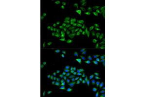 Immunofluorescence analysis of U2OS cells using PCM1 Rabbit pAb (ABIN7269217) at dilution of 1:50,1:100,1:200 (40x lens). (PCM1 anticorps  (AA 1-260))