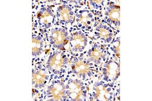 (ABIN656340 and ABIN2845640) staining I23O2 in Human small intestine tissue sections by Immunohistochemistry (IHC-P - paraformaldehyde-fixed, paraffin-embedded sections).