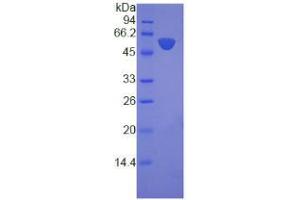 SDS-PAGE analysis of Human Laminin beta 3 Protein. (Laminin beta 3 Protéine)