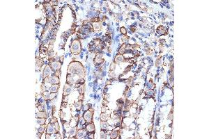 Immunohistochemistry of paraffin-embedded mouse stomach using VPS11 Rabbit mAb (ABIN7271272) at dilution of 1:100 (40x lens).
