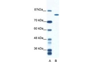 Western Blotting (WB) image for anti-DEAH (Asp-Glu-Ala-His) Box Polypeptide 16 (DHX16) antibody (ABIN2461579) (DHX16 anticorps)