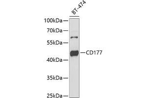 Western blot analysis of extracts of BT-474 cells, using CD177 antibody (ABIN6131282, ABIN6138125, ABIN6138127 and ABIN6222217) at 1:1000 dilution.