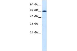 WB Suggested Anti-DACH2 Antibody Titration:  0. (DACH2 anticorps  (C-Term))