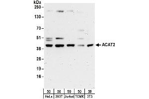 Western Blotting (WB) image for anti-Acetyl-CoA Acetyltransferase 2 (ACAT2) (AA 150-200) antibody (ABIN7454576) (ACAT2 anticorps  (AA 150-200))