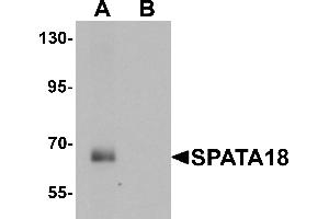 Western blot analysis of SPATA18 in rat lung tissue lysate with SPATA18 antibody at 1 µg/mL in (A) the absence and (B) the presence of blocking peptide (SPATA18 anticorps  (N-Term))