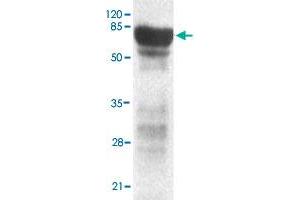 Western blot analysis of PHF2 monoclonal antibody  at 1 : 2000 dilution interacts with recombinant PHF2 protein with a GST tag.