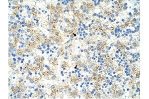 EXOSC6 antibody was used for immunohistochemistry at a concentration of 4-8 ug/ml to stain Hepatocytes (arrows) in Human Liver. (EXOSC6 anticorps  (N-Term))