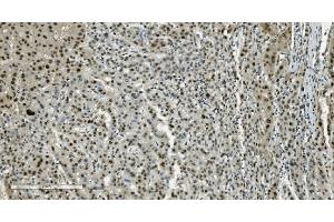 IHC analysis of Transketolase/TKT using anti-Transketolase/TKT antibody (ABIN7598958). (TKT anticorps  (AA 1-116))