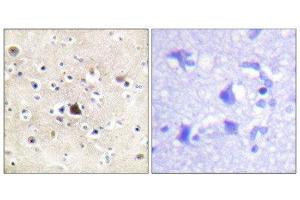 Immunohistochemistry (IHC) image for anti-GR (Internal Region), (pSer234), (Ser226), (Ser246) antibody (ABIN1847938) (GR (Internal Region), (pSer234), (Ser226), (Ser246) anticorps)