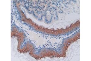 Used in DAB staining on fromalin fixed paraffin- embedded esophagus tissue (MPP2 anticorps  (AA 3-214))