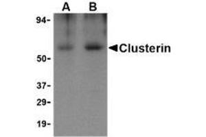 Western blot analysis of Clusterin in human brain tissue lysate with AP30239PU-N Clusterin body at (A) 0. (Clusterin anticorps  (Isoform 1))