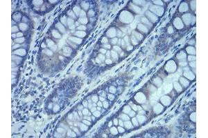 Immunohistochemical analysis of paraffin-embedded duodenum tissues using Rab5a mouse mAb with DAB staining.