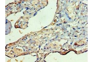 Immunohistochemistry of paraffin-embedded human placenta tissue using ABIN7167479 at dilution of 1:100 (RIPK3 anticorps  (AA 1-120))