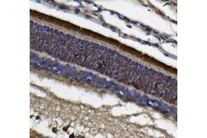 IHC analysis of PDE6 beta/PDE6B using anti-PDE6 beta/PDE6B antibody (ABIN7600892).