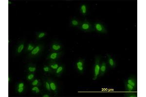 Immunofluorescence of monoclonal antibody to GATA2 on HeLa cell. (GATA2 anticorps  (AA 1-102))