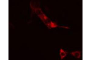 ABIN6266635 staining RAW264. (SNAP25 anticorps  (C-Term))