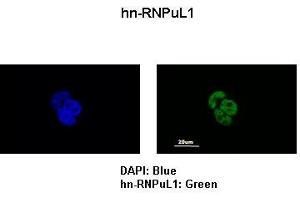 Sample Type :  MCF7 cells   Primary Antibody Dilution :   1:200   Secondary Antibody:  Anti-rabbit-FITC   Secondary Antibody Dilution:   1:500   Color/Signal Descriptions:  DAPI: Blue HNRNPUL1: Green   Gene Name:  HNRPUL1   Submitted by:  Anonymous