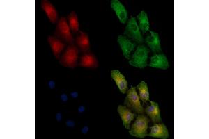 ABIN6257799 and ABIN6274834 staining  cells by IF/ICC.