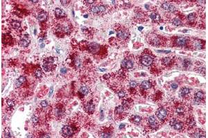 Human Liver (formalin-fixed, paraffin-embedded) stained with CAT antibody ABIN364408 at 2 ug/ml followed by biotinylated anti-goat IgG secondary antibody ABIN481715, alkaline phosphatase-streptavidin and chromogen.