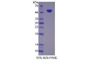 Image no. 1 for O6-Methylguanine-DNA-Methyltransferase (MGMT) (AA 1-209) protein (His tag,GST tag) (ABIN6237759)