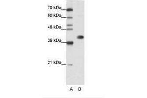 Image no. 3 for anti-Heterogeneous Nuclear Ribonucleoprotein A3 (HNRNPA3) (N-Term) antibody (ABIN202382) (HNRNPA3 anticorps  (N-Term))