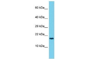Host: Rabbit Target Name: CCDC12 Sample Type: 721_B Whole Cell lysates Antibody Dilution: 1. (CCDC12 anticorps  (C-Term))