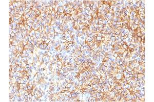 Formalin-fixed, paraffin-embedded human Pancreas stained with Spectrin beta III Monoclonal Antibody (SPTBN2/1584). (Spectrin, Beta, Non-erythrocytic 2 (SPTBN2) (AA 356-475) anticorps)