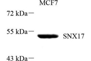 Western blot analysis of SNX17 (ABIN7075691),at dilution of 1: 800 (SNX17 anticorps)
