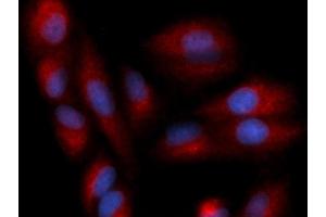Immunofluorescence (IF) image for anti-Chemokine (C-C Motif) Ligand 22 (CCL22) (AA 25-93) antibody (PE) (ABIN5566347) (CCL22 anticorps  (AA 25-93) (PE))
