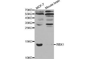 Western blot analysis of extracts of various cell lines, using RBX1 antibody. (RBX1 anticorps)