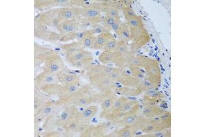 Immunohistochemistry of paraffin-embedded human liver using NME4 antibody at dilution of 1:100 (40x lens). (NME4 anticorps)