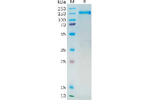 Human PSMA Protein, mFc Tag on SDS-PAGE under reducing condition.