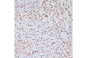 Immunohistochemistry of paraffin-embedded human uterus using Phospho-ERK1-Y204 antibody (ABIN3019889, ABIN3019890, ABIN3019891 and ABIN1681795) at dilution of 1:100 (40x lens).